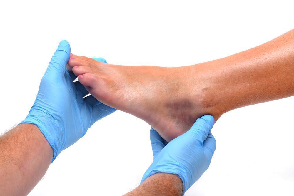 How to Crack Your Ankle - A Trustworthy Guide!